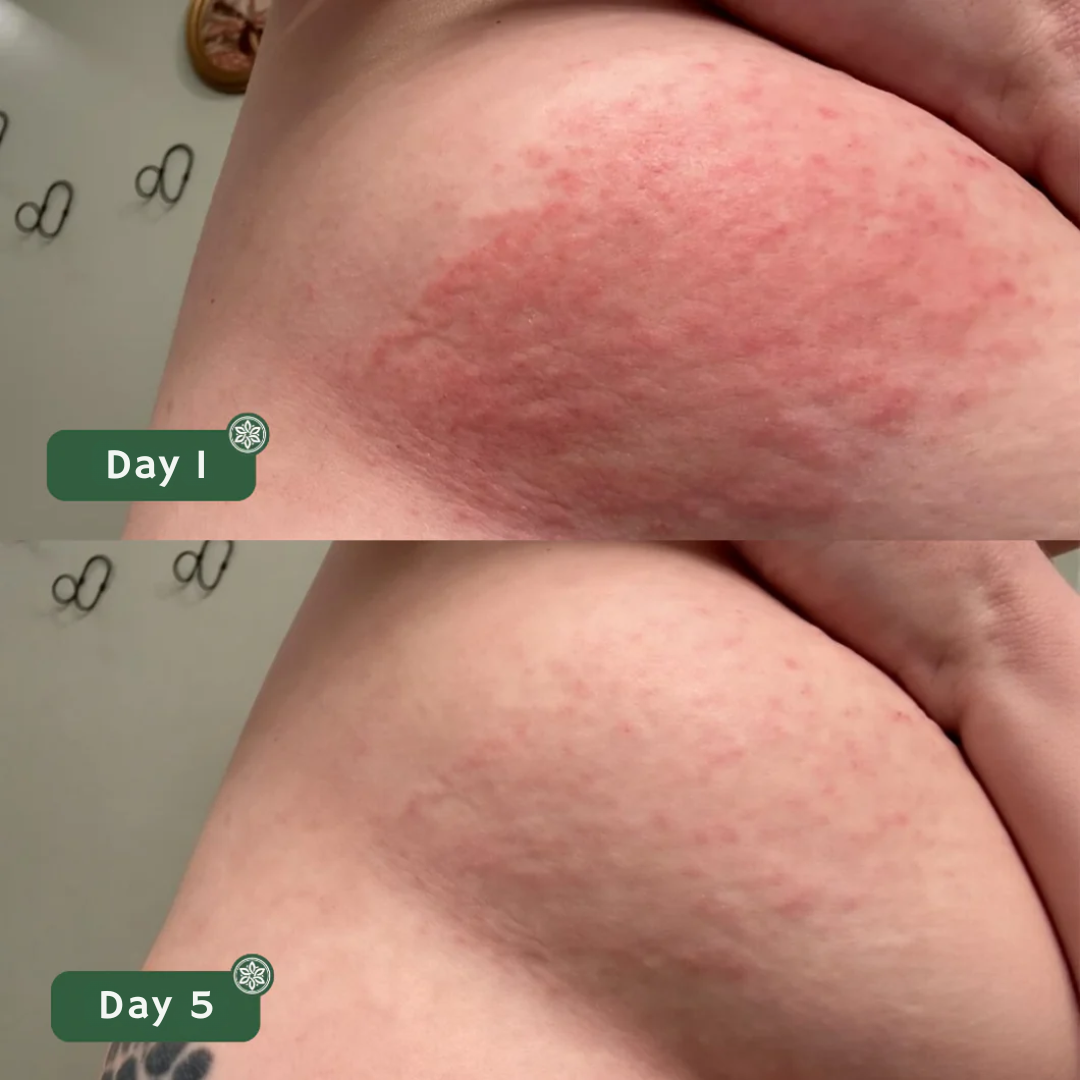 ANAÏS SKIN FOLD REPAIR CREAM