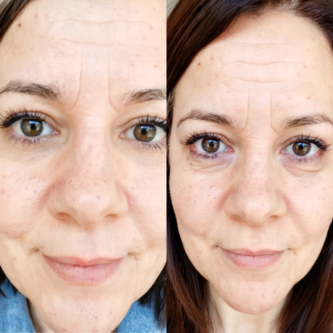 EYECLR® 2-in-1 Red Light Therapy + EMS To Erase Eye Bags